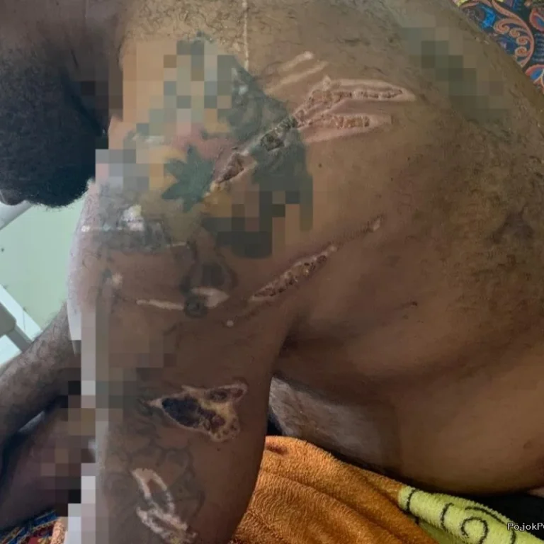 LBH Desak Komnas HAM Usut Dugaan Penyiksaan Tahanan di Polresta Sorong 11 LBH Desak Komnas HAM Usut Dugaan Penyiksaan Tahanan di Polresta Sorong I PojokPublik