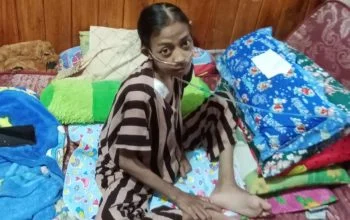Satu Tabung Oksigen untuk Bertahan Hidup, Kisah Pilu Siti Nurlela dari Ciamis